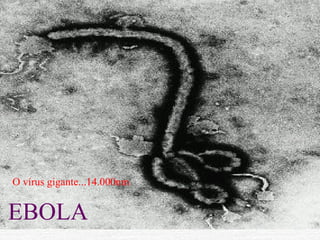 EBOLA
O vírus gigante...14.000nm
 