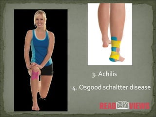 3. Achilis
4. Osgood schaltter disease