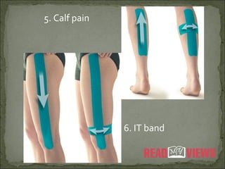 5. Calf pain
6. IT band