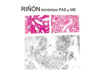 RIÑÓN  tricrómico PAS y ME 