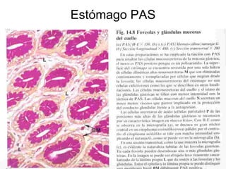 Estómago PAS 