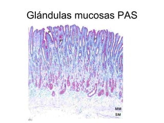 Glándulas mucosas PAS 