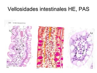 Vellosidades intestinales HE, PAS 