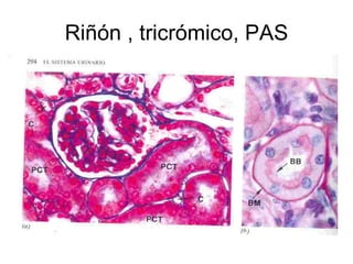 Riñón , tricrómico, PAS 