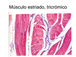 Músculo estriado, tricrómico 
