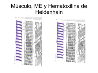Músculo, ME y Hematoxilina de Heidenhain 