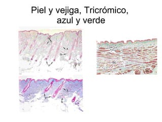 Piel y vejiga, Tricrómico,  azul y verde 
