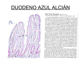 DUODENO AZUL ALCIÁN 