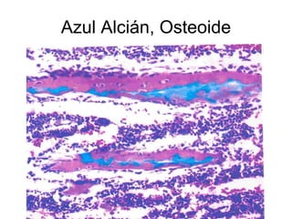 Azul Alcián, Osteoide 