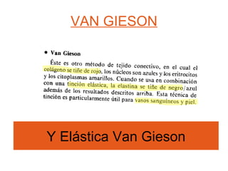 VAN GIESON Y Elástica Van Gieson 
