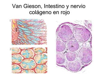 Van Gieson, Intestino y nervio  colágeno en rojo 