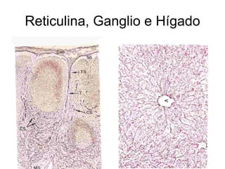 Reticulina, Ganglio e Hígado 