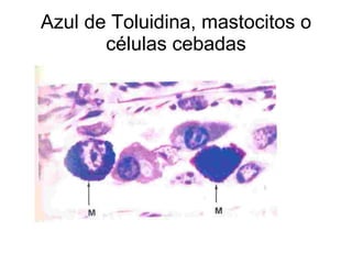 Azul de Toluidina, mastocitos o células cebadas 