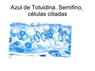 Azul de Toluidina. Semifino,  células ciliadas 