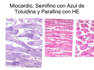 Miocardio, Semifino con Azul de Toluidina y Parafina con HE 