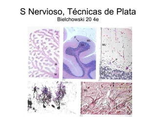S Nervioso, Técnicas de Plata  Bielchowski 20 4e 