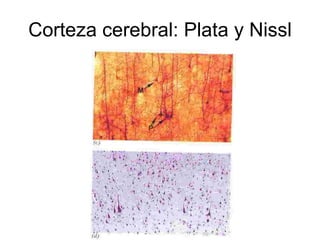 Corteza cerebral: Plata y Nissl 