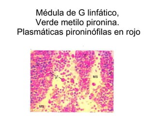 Médula de G linfático,  Verde metilo pironina.  Plasmáticas pironinófilas en rojo 