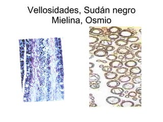 Vellosidades, Sudán negro Mielina, Osmio 