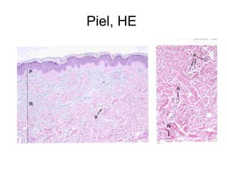Piel, HE  