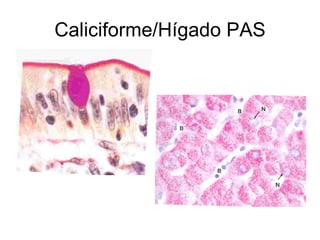 Caliciforme/Hígado PAS 