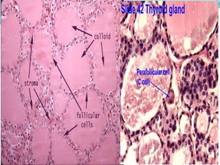 2 Thyroid gland pathology disorder I.pptx