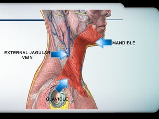 Company Logo
MANDIBLE
CLAVICLE
EXTERNAL JAGULAR
VEIN
 