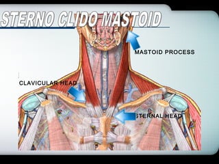 Company Logo
STERNAL HEAD
CLAVICULAR HEAD
MASTOID PROCESS
 