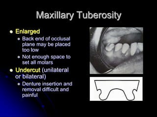 2 tissue response exam, preprosthetic | PPTX