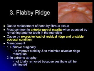 Flabby Ridge Radiograph 2 tissue response exam, preprosthetic | PPTX