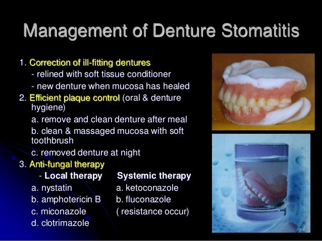 2 tissue response exam, preprosthetic 2 tissue response exam, preprosthetic