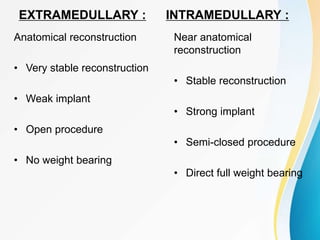 EXTRAMEDULLARY :
Anatomical reconstruction
• Very stable reconstruction
• Weak implant
• Open procedure
• No weight bearing
INTRAMEDULLARY :
Near anatomical
reconstruction
• Stable reconstruction
• Strong implant
• Semi-closed procedure
• Direct full weight bearing
 