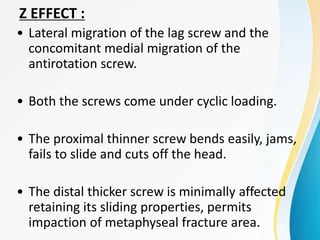 • Lateral migration of the lag screw and the
concomitant medial migration of the
antirotation screw.
• Both the screws come under cyclic loading.
• The proximal thinner screw bends easily, jams,
fails to slide and cuts off the head.
• The distal thicker screw is minimally affected
retaining its sliding properties, permits
impaction of metaphyseal fracture area.
Z EFFECT :
 