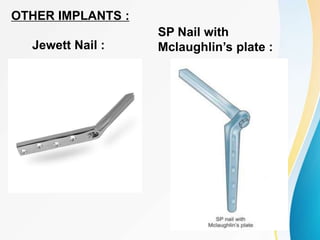 OTHER IMPLANTS :
Jewett Nail :
SP Nail with
Mclaughlin’s plate :
 