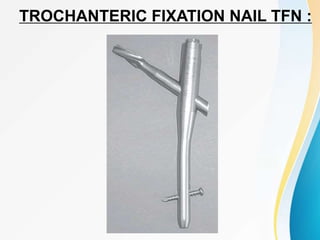 TROCHANTERIC FIXATION NAIL TFN :
 