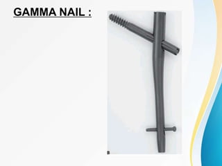 GAMMA NAIL :
 