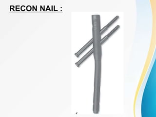 RECON NAIL :
 