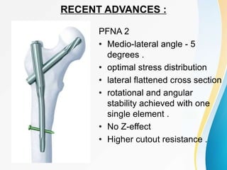 RECENT ADVANCES :
PFNA 2
• Medio-lateral angle - 5
degrees .
• optimal stress distribution
• lateral flattened cross section
• rotational and angular
stability achieved with one
single element .
• No Z-effect
• Higher cutout resistance .
 