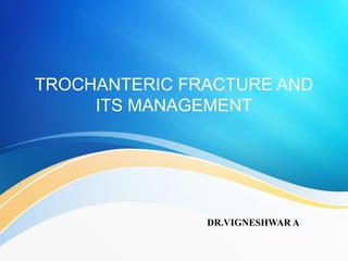 TROCHANTERIC FRACTURE AND
ITS MANAGEMENT
DR.VIGNESHWAR A
 