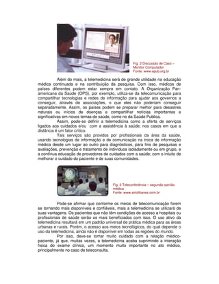 Além do mais, a telemedicina será de grande utilidade na educação
médica continuada e na contribuição da pesquisa. Com isso, médicos de
países diferentes podem estar sempre em contato. A Organização Pan-
americana da Saúde (OPS), por exemplo, utiliza-se da telecomunicação para
compartilhar tecnologias e redes de informação para ajudar aos governos a
conseguir, através de associações, o que eles não poderiam conseguir
separadamente. Assim, os países podem se preparar melhor para desastres
naturais ou inícios de doenças e compartilhar notícias importantes e
significativas em novos temas de saúde, como no da Saúde Publica.
Assim, pode-se definir a telemedicina como a oferta de serviços
ligados aos cuidados e/ou com a assistência à saúde, nos casos em que a
distância é um fator crítico.
Tais serviços são providos por profissionais da área da saúde,
usando tecnologias de informação e de comunicação na troca de informação
médica desde um lugar ao outro para diagnósticos, para fins de pesquisas e
avaliações, prevenção e tratamento de indivíduos isoladamente ou em grupo, e
a contínua educação de provedores de cuidados com a saúde; com o intuito de
melhorar o cuidado do paciente e de suas comunidades.
Pode-se afirmar que conforme os meios de telecomunicação forem
se tornando mais disponíveis e confiáveis, mais a telemedicina se utilizará de
suas vantagens. Os pacientes que não têm condições de acesso a hospitais ou
profissionais de saúde serão os mais beneficiados com isso. O uso ativo da
telemedicina resultará em um padrão universal de prática médica para as áreas
urbanas e rurais. Porém, o acesso aos meios tecnológicos, do qual depende o
uso da telemedicina, ainda não é disponível em todas as regiões do mundo.
Por isso, deve-se tomar muito cuidado com a relação médico-
paciente, já que, muitas vezes, a telemedicina acaba suprimindo a interação
física do exame clínico, um momento muito importante no ato médico,
principalmente no caso de teleconsulta.
Fig. 2 Discussão de Caso –
Monitor Computador
Fonte: www.epub.org.br
Fig. 3 Teleconferência – segunda opinião
médica
Fonte: www.siriolibanes.com.br
 