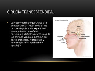 CIRUGÍA TRANSESFENOIDAL
• La descompresión quirúrgica y la
extirpación son necesarios en los
tumores hipofisarios expansivos
acompañados de cefalea
persistente, defectos progresivos de
los campos visuales, parálisis de
pares craneales, hidrocefalia y
hemorragia intra-hipofisaria o
apoplejía.
 