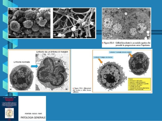 Varicosity trattamento fisso e dieta