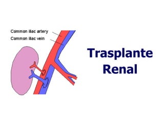 Trasplante Renal 