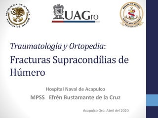 Traumatología y Ortopedia:.
Fracturas Supracondílias de
Húmero
Hospital Naval de Acapulco
MPSS Efrén Bustamante de la Cruz
Acapulco Gro. Abril del 2020
 