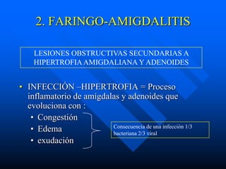 2. FARINGO-AMIGDALITIS

    LESIONES OBSTRUCTIVAS SECUNDARIAS A
    HIPERTROFIA AMIGDALIANA Y ADENOIDES


• INFECCIÓN –HIPERTROFIA = Proceso
  inflamatorio de amígdalas y adenoides que
  evoluciona con :
   • Congestión
   • Edema               Consecuencia de una infección 1/3
                         bacteriana 2/3 viral
   • exudación
 