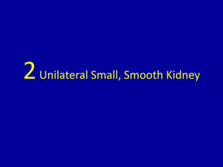 2Unilateral Small, Smooth Kidney
 