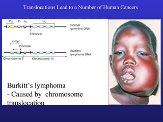 Translocations Lead to a Number of Human Cancers
Burkitt’s lymphoma
- Caused by chromosome
translocation
 