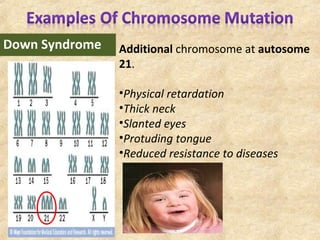 Down Syndrome Additional chromosome at autosome
21.
•Physical retardation
•Thick neck
•Slanted eyes
•Protuding tongue
•Reduced resistance to diseases
 