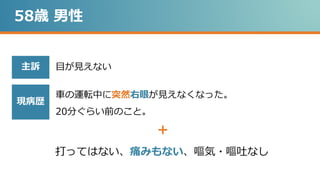 目が見えない
58歳 男性
車の運転中に突然右眼が見えなくなった。
20分ぐらい前のこと。
打ってはない、痛みもない、嘔気・嘔吐なし
主訴
現病歴
＋
 