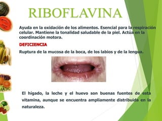 Ayuda en la oxidación de los alimentos. Esencial para la respiración
celular. Mantiene la tonalidad saludable de la piel. Actúa en la
coordinación motora.
DEFICIENCIA
Ruptura de la mucosa de la boca, de los labios y de la lengua.
El hígado, la leche y el huevo son buenas fuentes de esta
vitamina, aunque se encuentra ampliamente distribuida en la
naturaleza.
 
